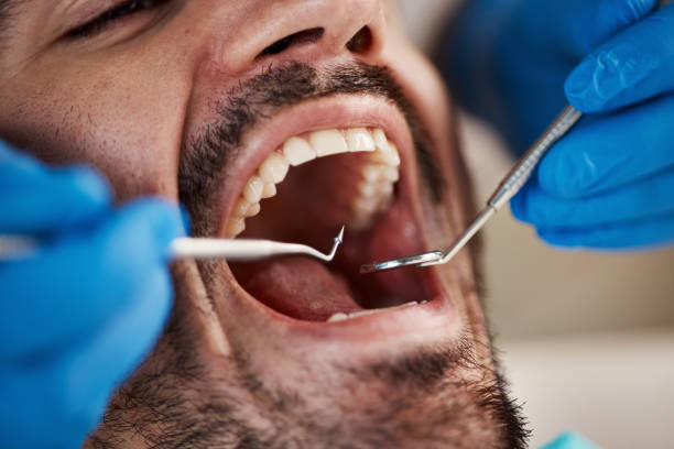 Best Emergency Treatment for Toothache in East Washington, PA